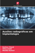 Aux?lios radiogrficos em Implantologia