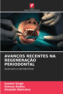 Avanos Recentes Na Regenerao Periodontal