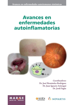 Avances en enfermedades autoinflamatorias - Cervera, Ricard, and Hernndez-Rodr?guez, Jos?, and Ar?stegui, Juan Ignacio