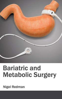 Bariatric and Metabolic Surgery - Redman, Nigel (Editor)