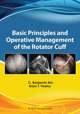 Basic Principles and Operative Management of the Rotator Cuff - Ma, C Benjamin, MD, and Feeley, Brian, MD