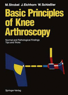 Basic Principles of Knee Arthroscopy: Normal and Pathological Findings Tips and Tricks