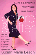 Before & After: Living & Eating Well After Weight Loss Surgery - Leach, Susan Nuziato