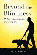 Beyond the Blindness: My Story of Losing Sight and Living Life