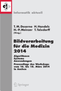 Bildverarbeitung Fr Die Medizin 2014: Algorithmen - Systeme - Anwendungen Proceedings Des Workshops Vom 16. Bis 18. Mrz 2014 in Aachen