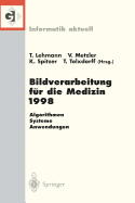 Bildverarbeitung Fur Die Medizin 1998: Algorithmen -- Systeme -- Anwendungen Proceedings Des Workshops Am 26. Und 27. Marz 1998 in Aachen - Lehmann, Thomas (Editor), and Metzler, Volker (Editor), and Spitzer, Klaus (Editor)