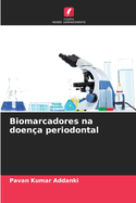 Biomarcadores na doen?a periodontal