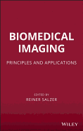 Biomedical Imaging: Principles and Applications