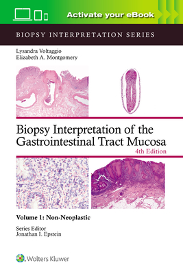 Biopsy Interpretation of the Gastrointestinal Tract Mucosa Volume 1: Non-Neoplastic: Print + eBook with Multimedia - VOLTAGGIO, LYSANDRA, and MONTGOMERY, ELIZABETH ANNE