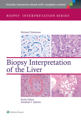 Biopsy Interpretation of the Liver - Torbenson, Michael, MD