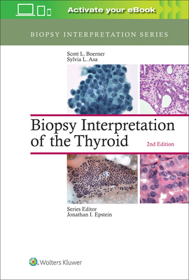 Biopsy Interpretation of the Thyroid - Boerner, Scott L, MD, and Asa, Sylvia L, MD