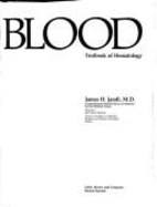 Blood: Textbook of Hematology