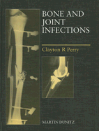 Bone and Joint Infections - Perry, Shannon E, RN, PhD, Faan