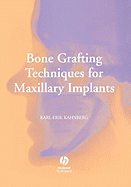 Bone Graft Maxil Implants