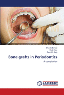 Bone Grafts in Periodontics