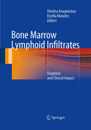 Bone Marrow Lymphoid Infiltrates: Diagnosis and Clinical Impact