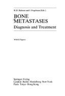 Bone Metastases: Diagnosis and Treatment - Rubens, R D