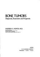 Bone tumors diagnosis, treatment and prognosis
