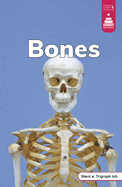 Bones