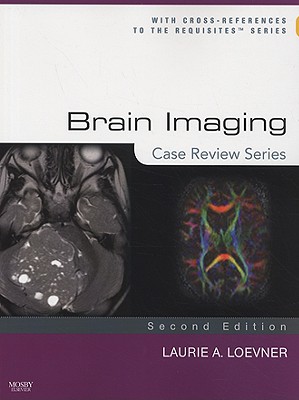 Brain Imaging: Case Review Series - Loevner, Laurie A, MD