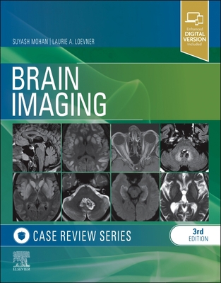 Brain Imaging Case Review - Mohan, Suyash, MD, and Loevner, Laurie A, MD