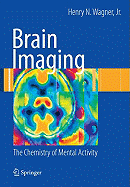 Brain Imaging: The Chemistry of Mental Activity