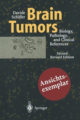 Brain Tumors: Biology, Pathology and Clinical References - Giordana, M T, and Schiffer, Davide, and Mauro, A