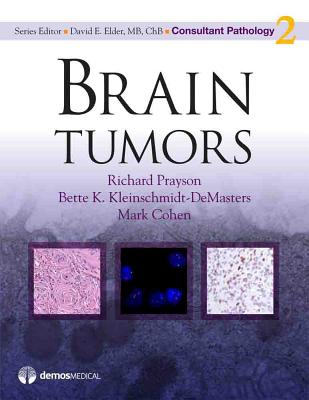 Brain Tumors - Prayson, Richard, MD, and Kleinschmidt-Demasters, Bette K, MD, and Cohen, Mark, MD