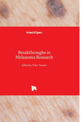 Breakthroughs in Melanoma Research - Tanaka, Yohei (Editor)