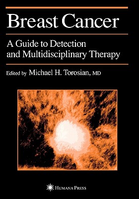 Breast Cancer: A Guide to Detection and Multidisciplinary Therapy - Torosian, Michael H. (Editor)