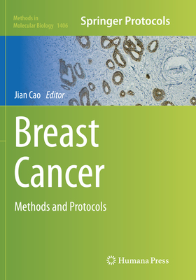 Breast Cancer: Methods and Protocols - Cao, Jian (Editor)