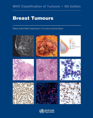 Breast Tumours: Who Classification of Tumours - Who Classification of Tumours Editorial Board (Editor)