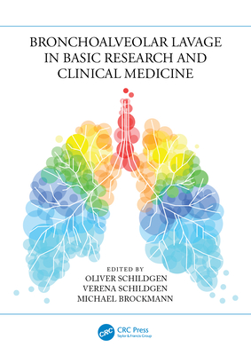 Bronchoalveolar Lavage in Basic Research and Clinical Medicine - Schildgen, Oliver (Editor), and Schildgen, Verena (Editor), and Brockmann, Michael (Editor)