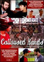 Calloused Hands - Jesse Quinones