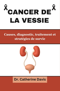 Cancer de la vessie: Causes, diagnostic, traitements et strat?gies de survie