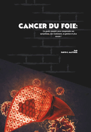 Cancer du foie: Un guide complet pour comprendre ses sympt?mes, son traitement, sa gestion et plus encore !