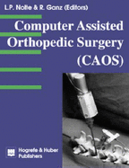 CAOS: Computer-assisted Orthopedic Surgery