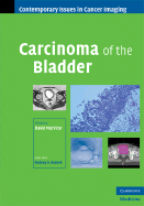 Carcinoma of the Bladder - MacVicar, David (Editor)