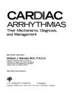 Cardiac Arrhythmias: Their Mechanisms, Diagnosis, and Management
