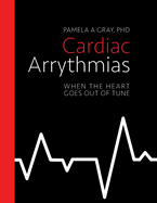 Cardiac Arrythmias: When the heart goes out of tune