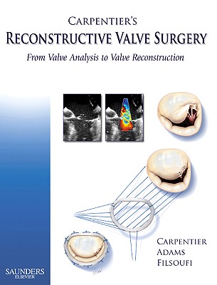 Carpentier's Reconstructive Valve Surgery: From Valve Analysis to Valve Reconstruction - Carpentier, Alain, M.D, and Adams, David H, MD, and Filsoufi, Farzan, MD