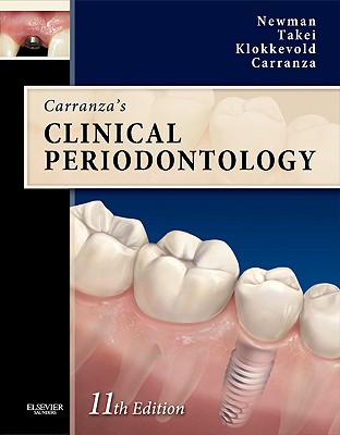 Carranza's Clinical Periodontology Expert Consult: Text with Continually Updated Online Reference - Newman, Michael G, Dds, and Takei, Henry, Dds, MS, and Klokkevold, Perry R, Dds, MS