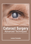 Cataract Surgery: Advanced Techniques