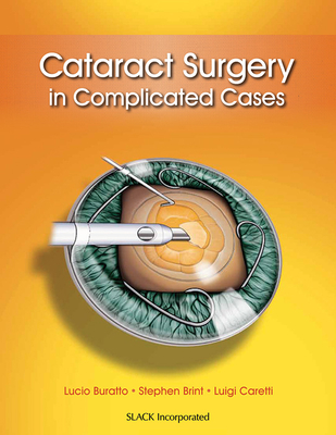 Cataract Surgery in Complicated Cases - Buratto, Lucio, Dr., MD, and Brint, Stephen, MD, and Caretti, Luigi, MD