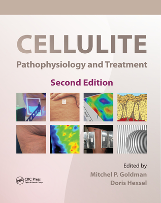 Cellulite: Pathophysiology and Treatment - Goldman, Mitchel P. (Editor), and Hexsel, Doris (Editor)