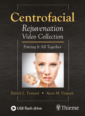 Centrofacial Rejuvenation Video Collection: Putting It All Together - Tonnard, Patrick, and Verpaele, Alexis