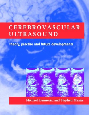 Cerebrovascular Ultrasound: Theory, Practice and Future Developments - Hennerici, Michael G (Editor), and Meairs, Stephen P (Editor)