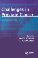 Challenges in Prostate Cancer