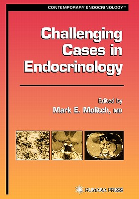 Challenging Cases in Endocrinology - Molitch, Mark E. (Editor)