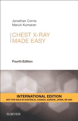 Chest X-Ray Made Easy - Corne, Jonathan, and Kumaran, Maruti